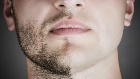 Men might have beards, but compared to other mammals we're pretty bare-faced (Thinkstock)