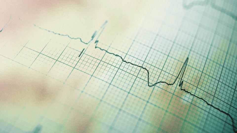 How It Feels To Live With The Possibility Of Sudden Death - 