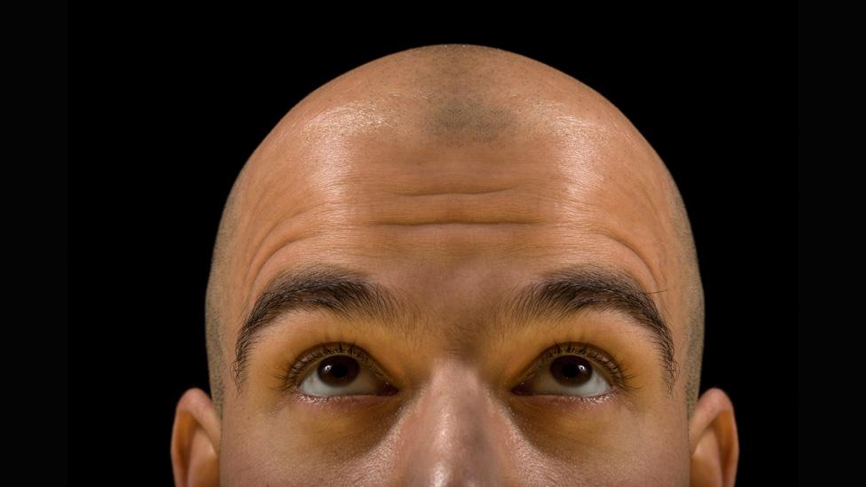 Will We Ever Banish Baldness Bbc Future