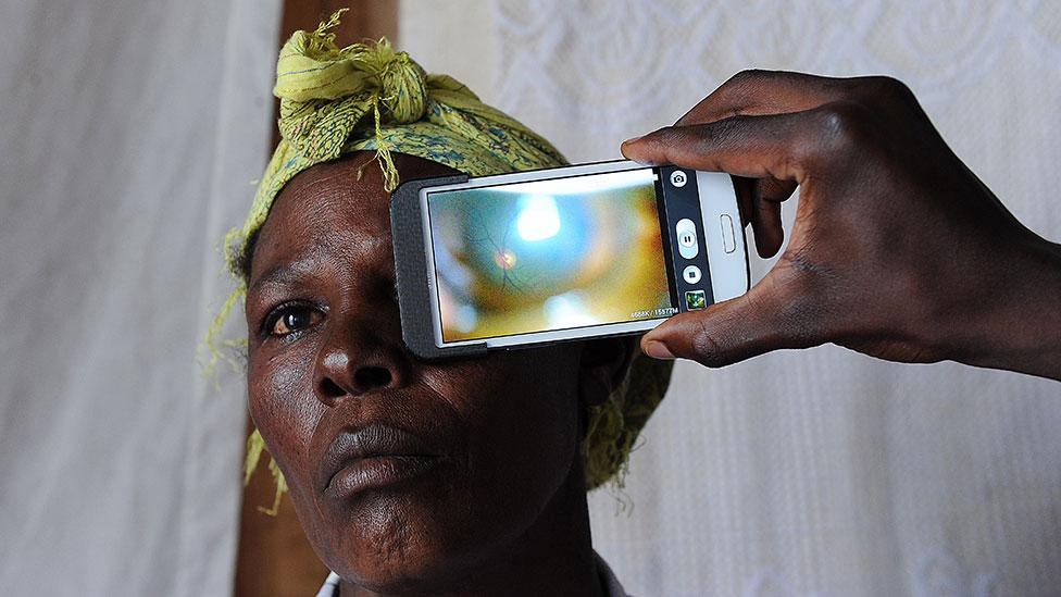 Smartphone cameras can also detect eye disease (Tony Karumba/AFP) Smartphone cameras can also detect eye disease (Tony Karumba/AFP)