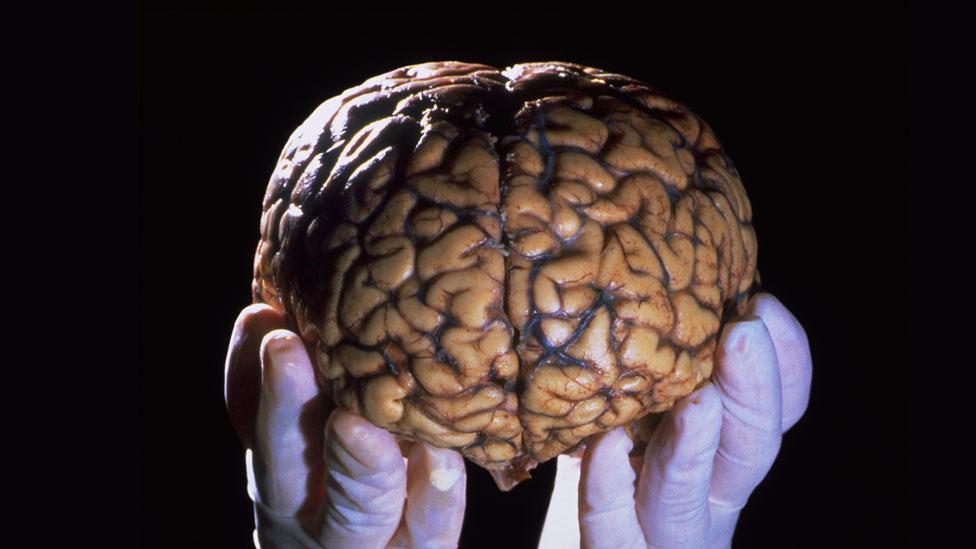 И голова без мозгов. Человеческий мозг в руках.