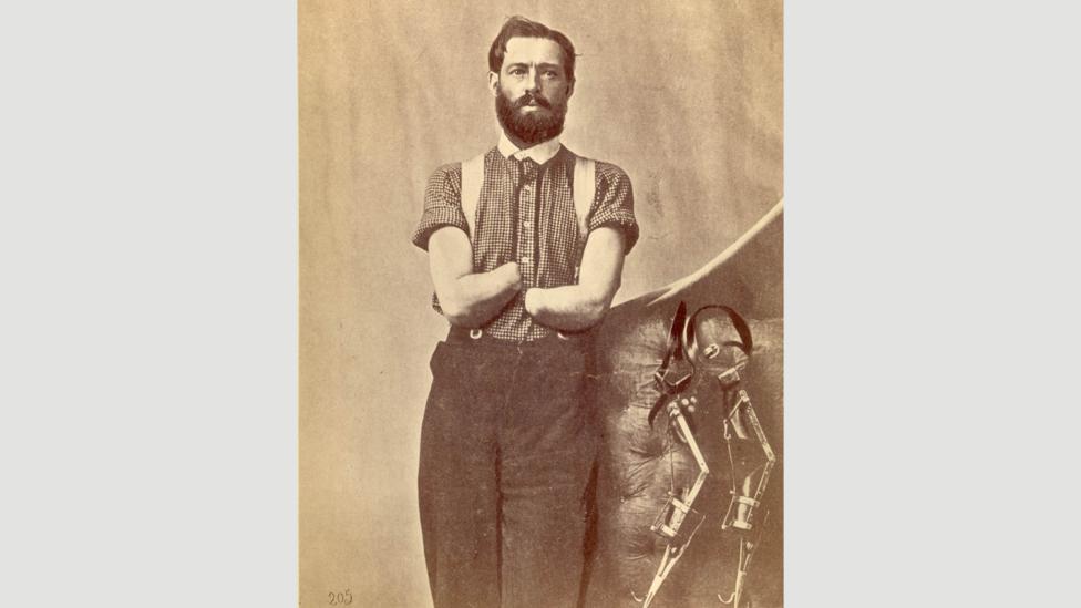 (Credit: National Museum of Health and Medicine CC BY 2.0) (Credit: National Museum of Health and Medicine CC BY 2.0)
