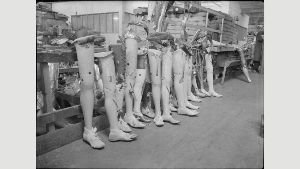 Queen Mary’s Hospital, Roehampton became an important centre for manufacturing limbs (Credit: Imperial War Museum CC BY 2.0/Wikimedia) Queen Mary’s Hospital, Roehampton became an important centre for manufacturing limbs (Credit: Imperial War Museum CC BY 2.0/Wikimedia)