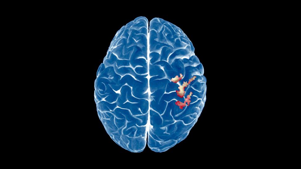 To the surprise of scientists, the brain lit up inside scanners when people were doing nothing (Credit: SPL) To the surprise of scientists, the brain lit up inside scanners when people were doing nothing (Credit: SPL)