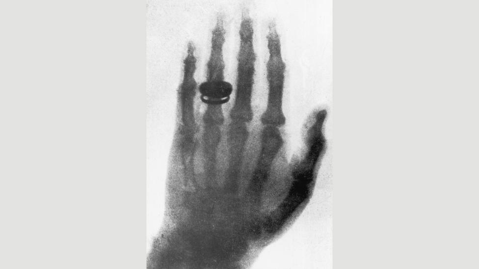 The secret history of Xray specs BBC Future