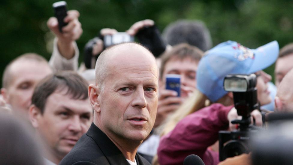 The Benefits Of Going Bald Bbc Future