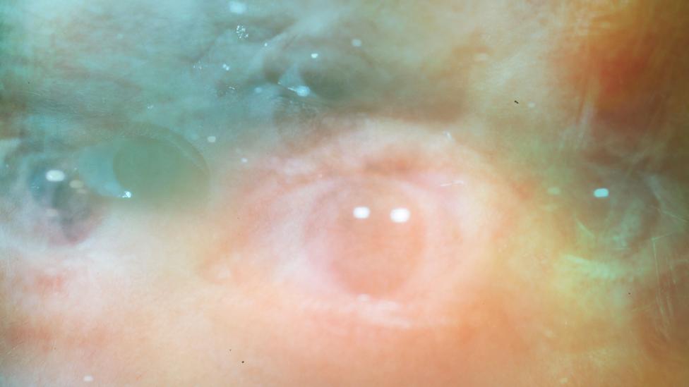 Will we ever find a way to correct this warped perception of threat and cure anxiety? (Credit: iStock) Will we ever find a way to correct this warped perception of threat and cure anxiety? (Credit: iStock)