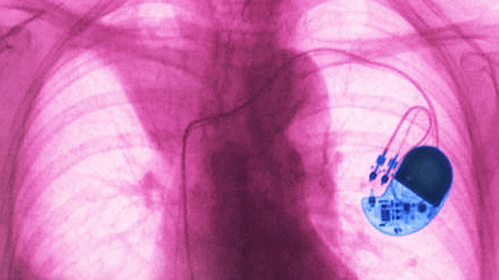 How hacking the human heart could replace pill popping P07y2xf2